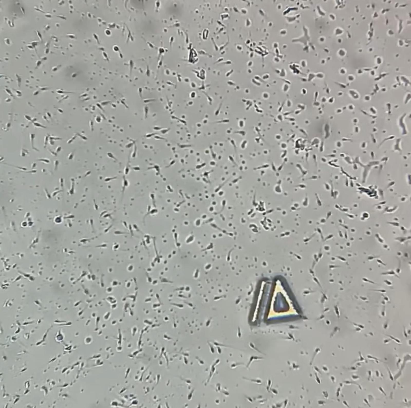 Whiskey semen analysis sample